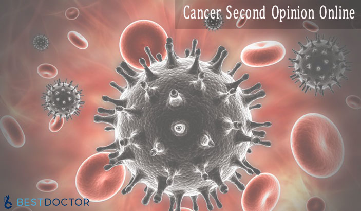 Cancer Second Opinion Online-and how to consult oncologist online