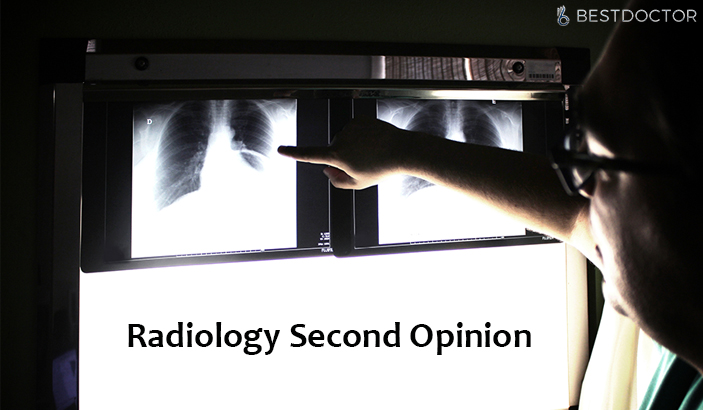 Rediology second opinion