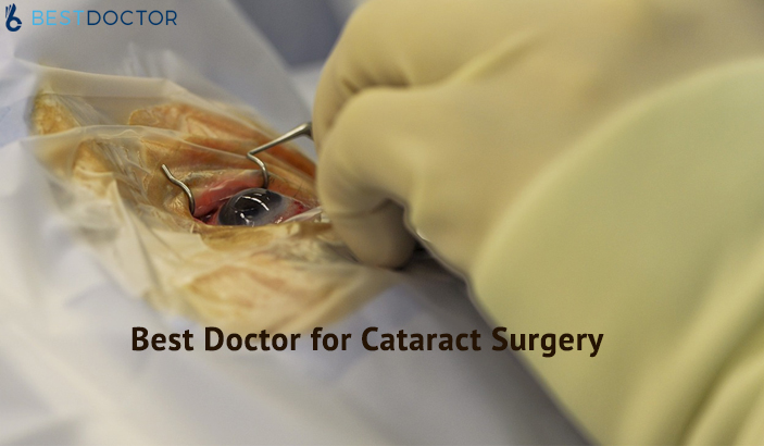How to find best doctor for cataract surgery -ask a doctor online - bestdoctor.com