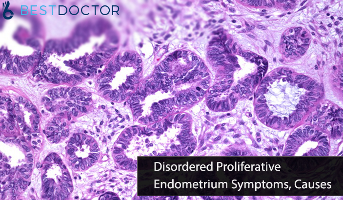 Disordered Proliferative Endometrium symptoms and causes and how to consult a doctor