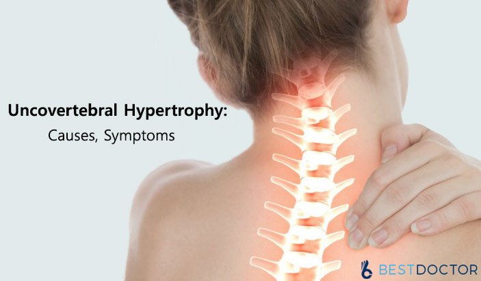 Uncovertebral hypertrophy: Causes, Symptoms and Treatment
