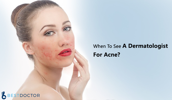 When To See A Dermatologist For Acne