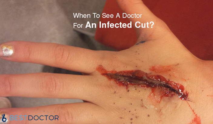 When to see a doctor for an infected cut?