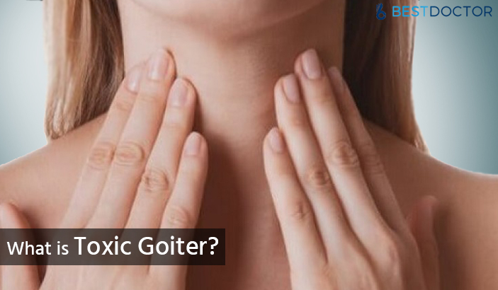 What is Toxic Goiter?