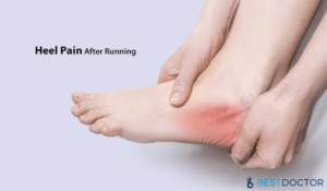 Heel Pain After Running - Causes, Treatment And Prevention By Dr.Ahmed