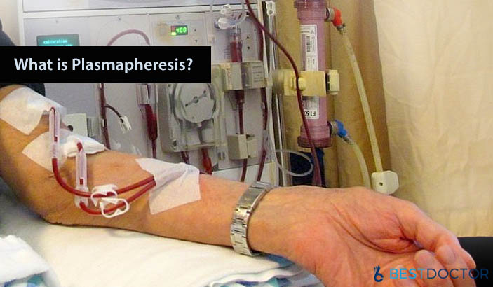 What is Plasmapheresis