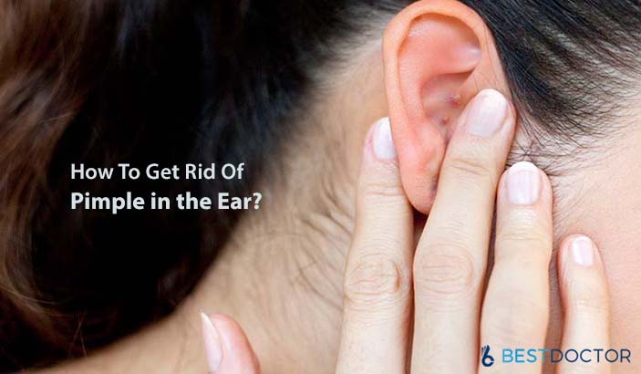 How To Get Rid Of Pimple in the Ear?