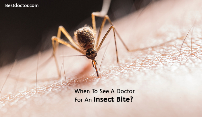 When To See A Doctor For An Insect Bite?
