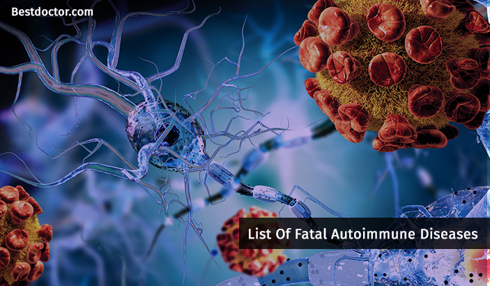 List of fatal autoimmune diseases
