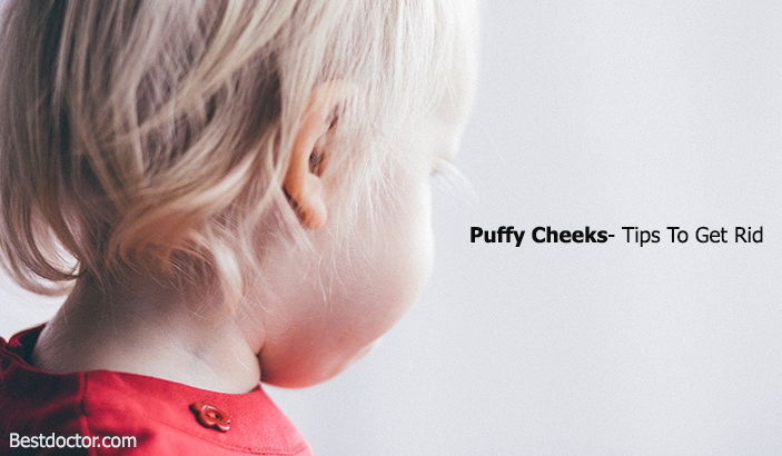 Puffy Cheeks- Tips To Get Rid