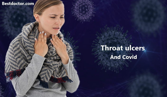 Throat ulcers And Covid