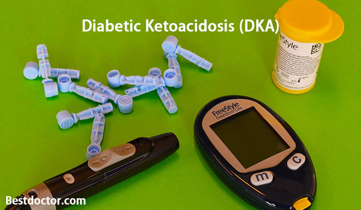 Diabetic Ketoacidosis (Dka) - Causes, Signs & Treatment