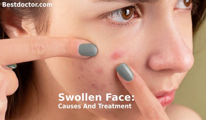 Swollen Face: Causes And Treatment