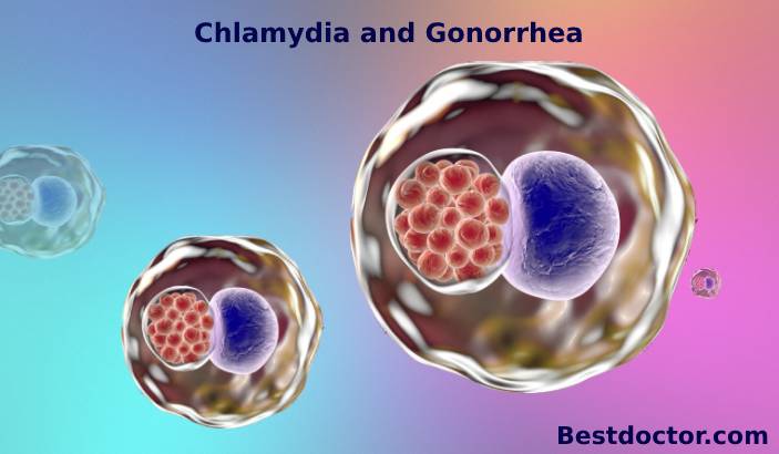 Chlamydia and Gonorrhea - Symptoms, Tests & Treatment