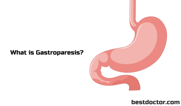 what is gastroporesis